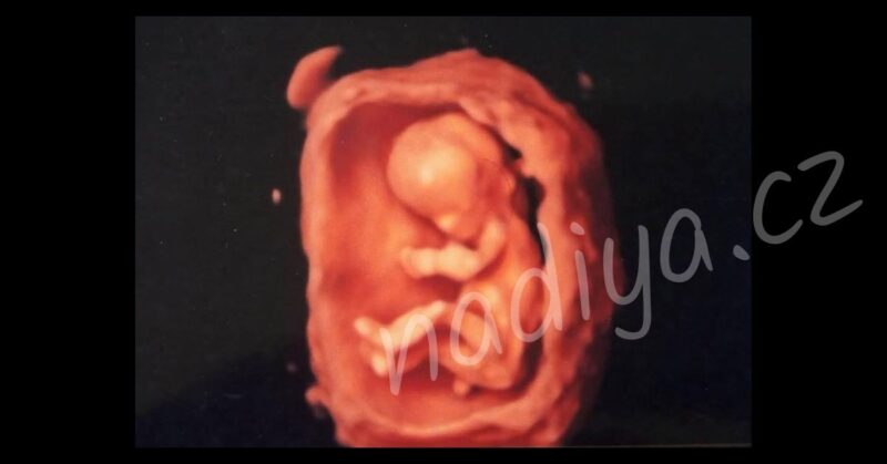 mimino porod podorní dula přirozený porod alternativní osobní kouč rodové linie yoni a děloha